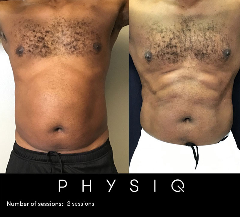 Physiq Before After 4 1