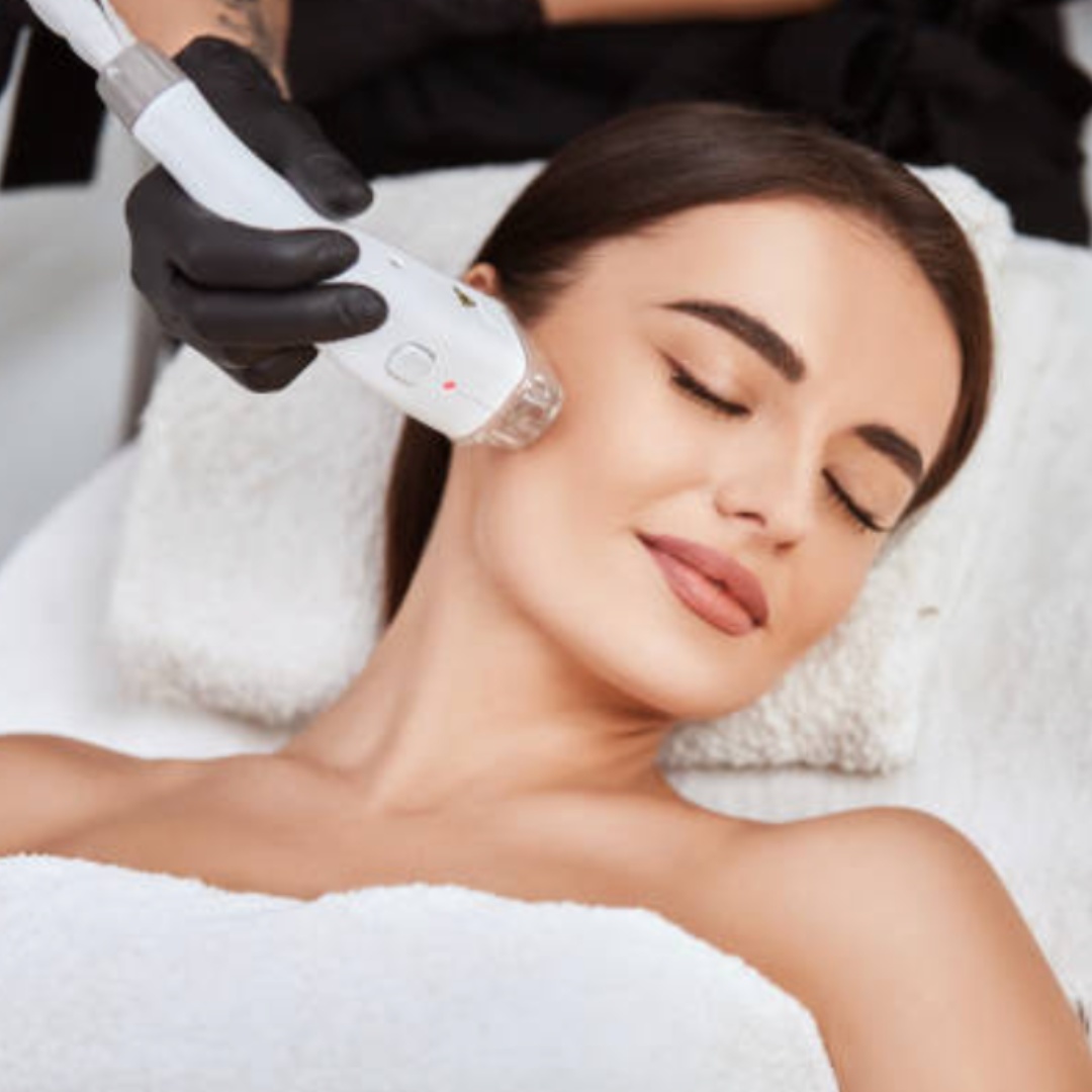 Virtue RF Microneedling